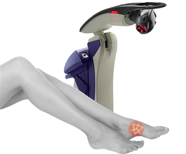 What To Expect With MLS Laser Therapy Treatment